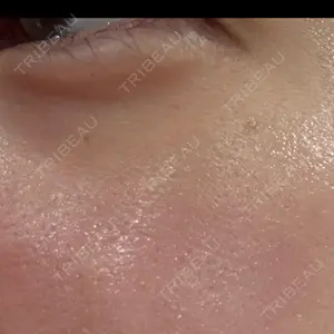 フィラークリニック フィラークリニック 名古屋栄院口コミ