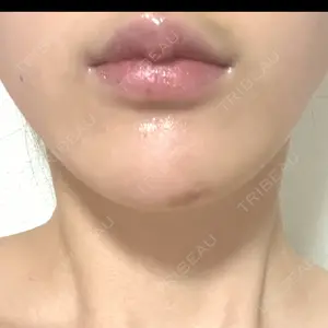 アリエル美容クリニック アリエル美容クリニック 横浜院口コミ