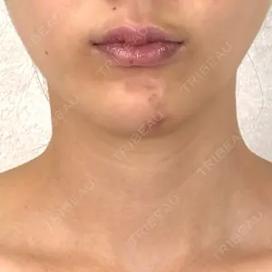 アリエル美容クリニック アリエル美容クリニック 横浜院口コミ