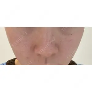 ミニマムスキンクリニック ミニマムスキンクリニック池袋口コミ