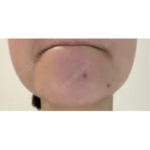 ミニマムスキンクリニック ミニマムスキンクリニック池袋口コミ