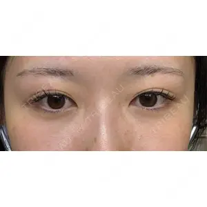 APOLLO BEAUTY CLINIC口コミ