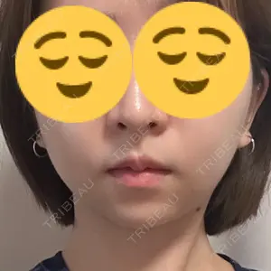 東京ココセランクリニック口コミ