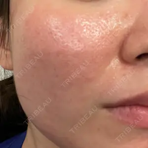 東京素肌クリニック 東京素肌クリニック 銀座本院口コミ