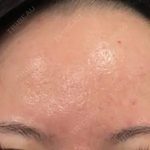 東京素肌クリニック 東京素肌クリニック 銀座本院口コミ