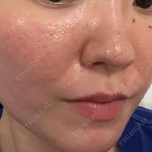 東京素肌クリニック 東京素肌クリニック 銀座本院口コミ