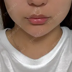 ルラ美容クリニック 渋谷本院の