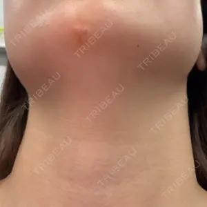 ルラ美容クリニック 渋谷本院の