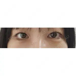 LOUIS CLINIC 二子玉川院【ルイクリニック】口コミ