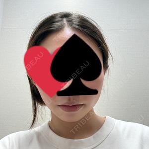 東京美容外科 東京美容外科 池袋院口コミ