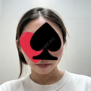 APスキンクリニック銀座口コミ