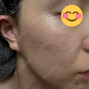 L‘amour clinic Tokyo【ラムールクリニック東京】口コミ