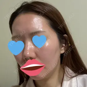 口コミ