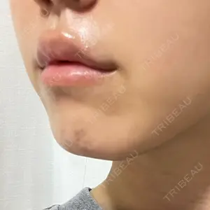 プライベートスキンクリニック 梅田本院口コミ