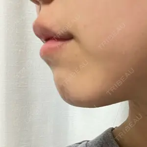 プライベートスキンクリニック 梅田本院口コミ