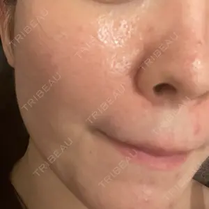 東京素肌クリニック 東京素肌クリニック 銀座本院口コミ