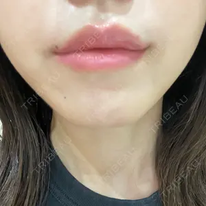 プライベートスキンクリニック 梅田本院口コミ