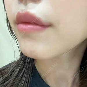 プライベートスキンクリニック 梅田本院口コミ