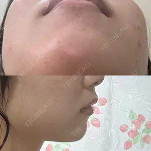 TCB東京中央美容外科 TCB東京中央美容外科 梅田茶屋町院口コミ