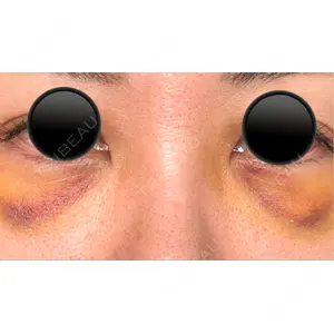 APOLLO BEAUTY CLINIC口コミ