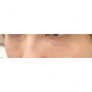 しのぶ皮膚科口コミ