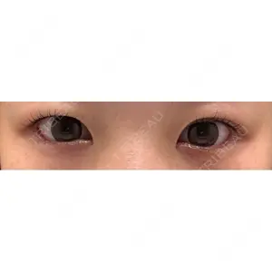 LOUIS CLINIC 二子玉川院【ルイクリニック】口コミ