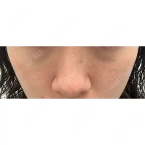 ミニマムスキンクリニック ミニマムスキンクリニック池袋口コミ