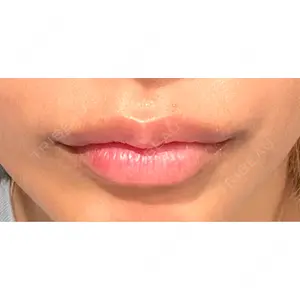 新未来クリニック口コミ