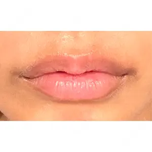 新未来クリニック口コミ