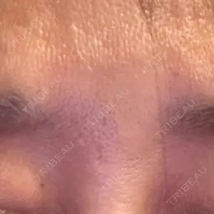 TCB東京中央美容外科 TCB東京中央美容外科 町田院口コミ