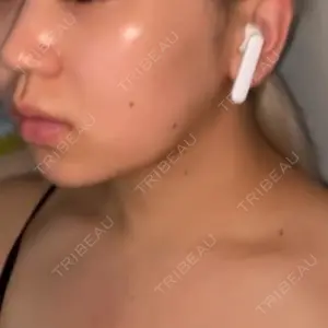 ルラ美容クリニック ルラ美容クリニック 大阪心斎橋院口コミ