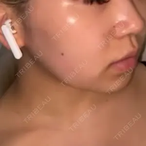 ルラ美容クリニック ルラ美容クリニック 大阪心斎橋院口コミ