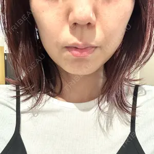 TCB東京中央美容外科 TCB東京中央美容外科 大宮西口院口コミ