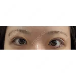 MIYAフェイスクリニック口コミ