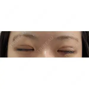 MIYAフェイスクリニック口コミ