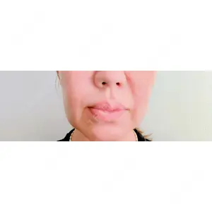 アリエル美容クリニック アリエル美容クリニック 横浜院口コミ