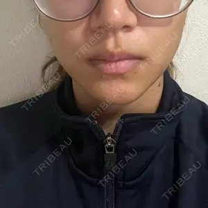 APスキンクリニック銀座口コミ