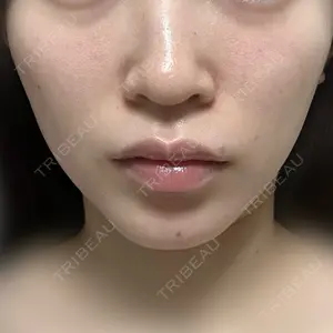 CZEN CLINIC 銀座院口コミ