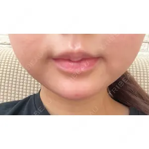 プロクリニック PRO CLINIC プロクリニック 銀座院口コミ