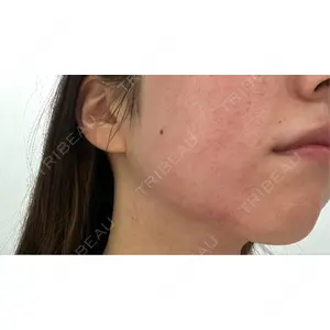 ルラ美容クリニック ルラ美容クリニック 仙台院 / ルラスキンクリニック 仙台院口コミ