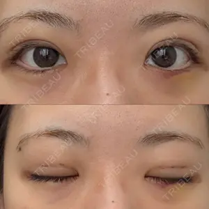 MIYAフェイスクリニック口コミ