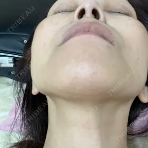 ヴァージンクリニックの口コミ