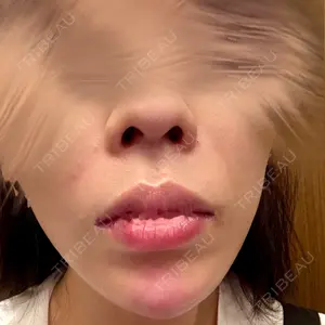 plume clinic plume clinic口コミ