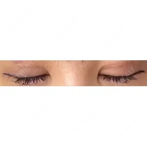 アリエル美容クリニック アリエル美容クリニック 横浜院口コミ