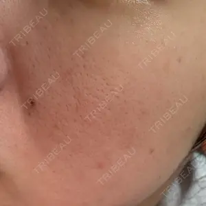 ルラ美容クリニック ルラ美容クリニック 福岡本院口コミ