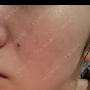 ルラ美容クリニック ルラ美容クリニック 福岡本院口コミ