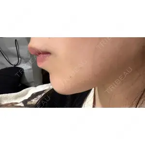 銀座みゆき通り美容外科の口コミ