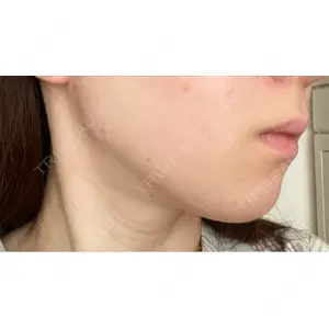 TCB東京中央美容外科 TCB東京中央美容外科 名古屋栄院口コミ