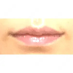 LOUIS CLINIC 二子玉川院【ルイクリニック】口コミ