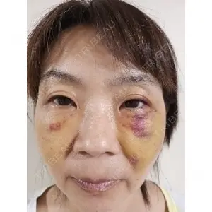 湘南美容クリニック 湘南美容クリニック 千葉センシティ院口コミ